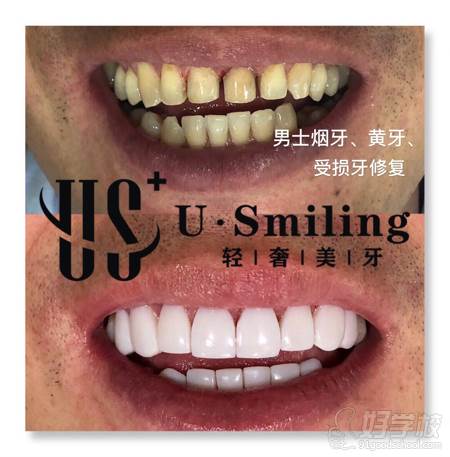 牙齿形态dsd微笑曲线设计 18.口腔检测技术 19.超声波洁牙技术 20.