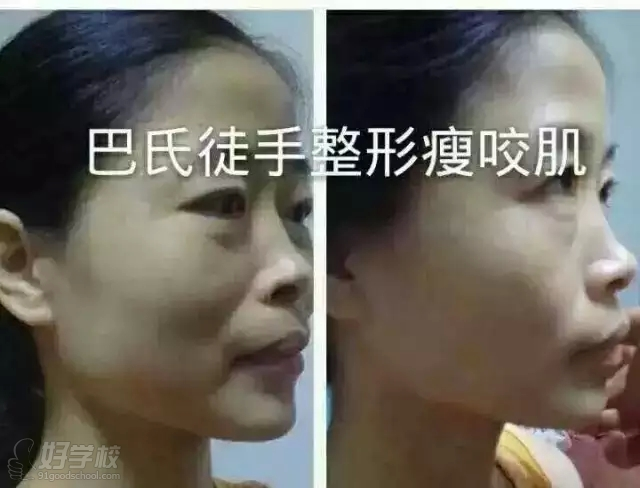 巴俊徒手整形推出全科班实用班,在面部精雕基础上增加身体精雕,培训