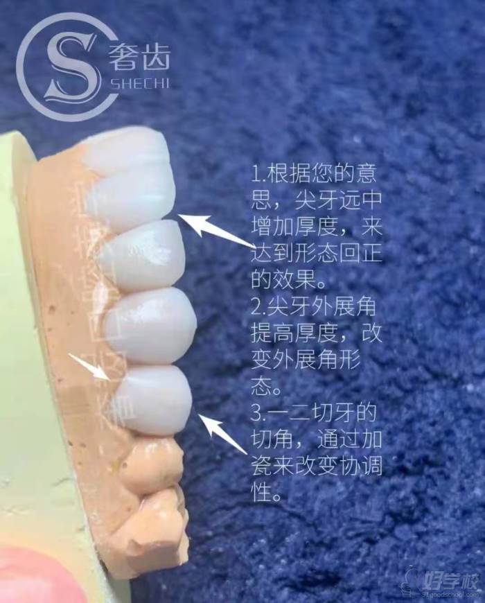 牙齿结构介绍