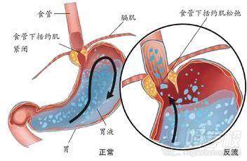 寶寶腸道展示