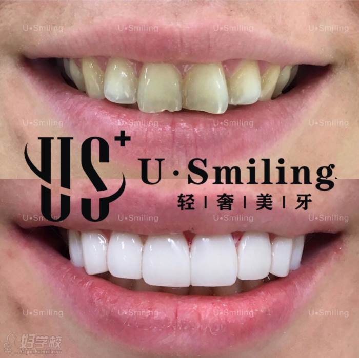 武漢U.SMILING輕奢美牙學院 