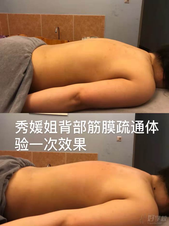 秀媛姐背部筋膜疏通體驗一次效果