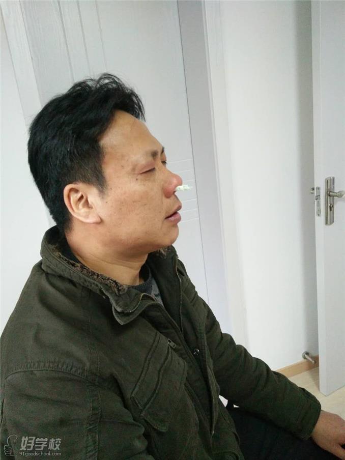 上海王式中医推拿针灸培训学院鼻炎疗法实践展示